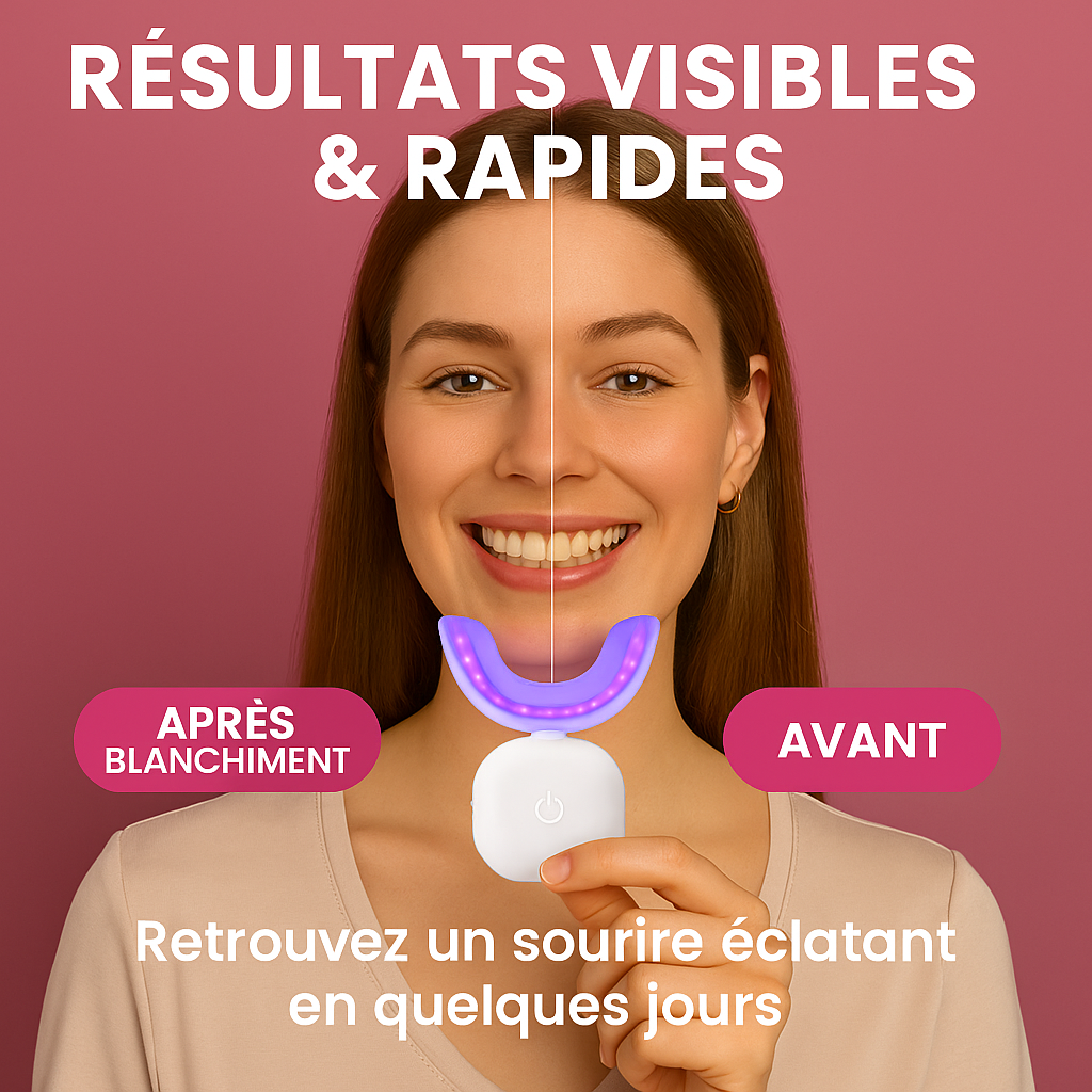 Lampe de blanchiment dentaires